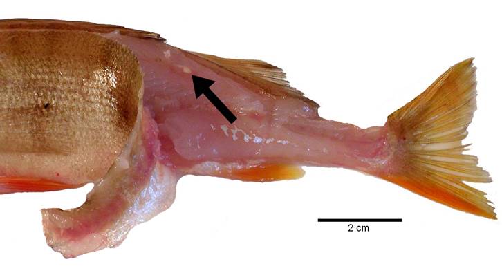 Bandwurm Dibothriocephalus latus